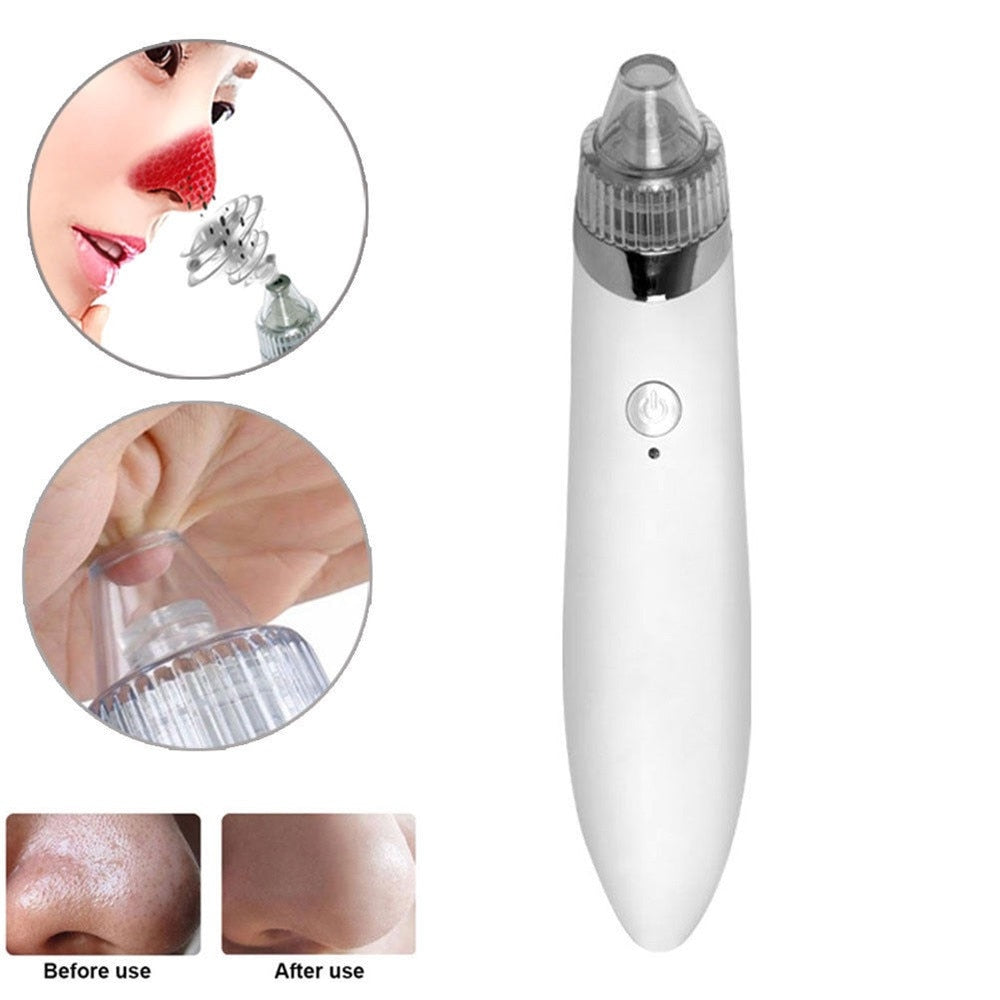Vacuum Pore Cleanser — product photo 3